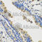 Interleukin 36 Gamma antibody, A8304, ABclonal Technology, Immunohistochemistry paraffin image 