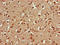 Proteasome Subunit Alpha 5 antibody, LS-C679227, Lifespan Biosciences, Immunohistochemistry paraffin image 