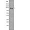 Forkhead Box O3 antibody, PA5-64554, Invitrogen Antibodies, Western Blot image 