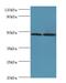 Adaptor Related Protein Complex 1 Subunit Mu 2 antibody, MBS1494956, MyBioSource, Western Blot image 