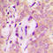 Signal Transducing Adaptor Molecule 2 antibody, LS-C368522, Lifespan Biosciences, Immunohistochemistry frozen image 