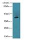 ACTH antibody, LS-C394707, Lifespan Biosciences, Western Blot image 