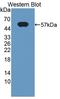 Chymotrypsin C antibody, LS-C372699, Lifespan Biosciences, Western Blot image 