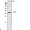 Cathepsin B antibody, LS-C813353, Lifespan Biosciences, Western Blot image 