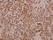 Collagen Type V Alpha 1 Chain antibody, A02283-1, Boster Biological Technology, Immunohistochemistry frozen image 