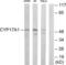 Cyp17 antibody, LS-C119484, Lifespan Biosciences, Western Blot image 