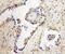 CCR4-NOT Transcription Complex Subunit 4 antibody, 12564-1-AP, Proteintech Group, Immunohistochemistry paraffin image 