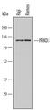 Protein Kinase D3 antibody, AF6478, R&D Systems, Western Blot image 