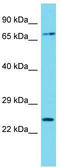 Coiled-Coil Domain Containing 81 antibody, TA330709, Origene, Western Blot image 