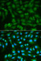 Sorbitol Dehydrogenase antibody, STJ25655, St John