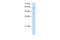 Ariadne RBR E3 Ubiquitin Protein Ligase 2 antibody, PA5-68637, Invitrogen Antibodies, Western Blot image 