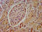 Huntingtin Interacting Protein 1 Related antibody, CSB-PA010366LA01HU, Cusabio, Immunohistochemistry paraffin image 