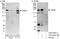 Kinase D Interacting Substrate 220 antibody, A303-002A, Bethyl Labs, Western Blot image 