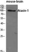 Ataxin 1 antibody, A01786-1, Boster Biological Technology, Western Blot image 