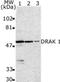 Serine/Threonine Kinase 17a antibody, NBP1-76896, Novus Biologicals, Western Blot image 