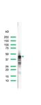 CD79a antibody, PA5-32333, Invitrogen Antibodies, Western Blot image 