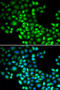 Forkhead Box P1 antibody, STJ27225, St John