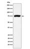 TFIIH basal transcription factor complex helicase XPD subunit antibody, M00694-1, Boster Biological Technology, Western Blot image 