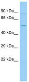 Prolyl-TRNA Synthetase 2, Mitochondrial antibody, TA334345, Origene, Western Blot image 