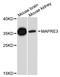 Microtubule Associated Protein RP/EB Family Member 3 antibody, STJ113659, St John