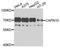 Calpain 10 antibody, A9865, ABclonal Technology, Western Blot image 