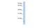 Achaete-Scute Family BHLH Transcription Factor 4 antibody, PA5-43650, Invitrogen Antibodies, Western Blot image 