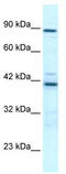 T-Box 5 antibody, TA334173, Origene, Western Blot image 