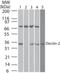 C-Type Lectin Domain Containing 6A antibody, NBP2-27159, Novus Biologicals, Western Blot image 