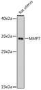 Matrix Metallopeptidase 7 antibody, GTX32725, GeneTex, Western Blot image 