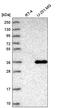QSOX1 antibody, HPA045725, Atlas Antibodies, Western Blot image 