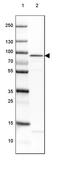 Adenosine Monophosphate Deaminase 1 antibody, PA5-55761, Invitrogen Antibodies, Western Blot image 
