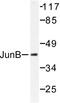 JunB Proto-Oncogene, AP-1 Transcription Factor Subunit antibody, LS-C176087, Lifespan Biosciences, Western Blot image 