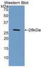 Complement Component 4 Binding Protein Beta antibody, LS-C305683, Lifespan Biosciences, Western Blot image 