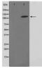 FERM, RhoGEF and pleckstrin domain-containing protein 2 antibody, TA347647, Origene, Western Blot image 