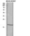 Transforming Growth Factor Alpha antibody, STJ97655, St John