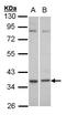 Complement Component 5a Receptor 2 antibody, GTX100359, GeneTex, Western Blot image 