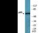 p65 antibody, EKC2475, Boster Biological Technology, Western Blot image 