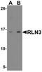 Relaxin 3 antibody, NBP2-41317, Novus Biologicals, Western Blot image 