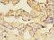 Transmembrane P24 Trafficking Protein 3 antibody, A61350-100, Epigentek, Immunohistochemistry paraffin image 