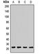 ADP Ribosylation Factor 5 antibody, LS-C667684, Lifespan Biosciences, Western Blot image 