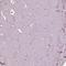 Sorcin antibody, HPA019004, Atlas Antibodies, Immunohistochemistry frozen image 