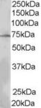 Lymphocyte-specific adapter protein Lnk antibody, MBS421417, MyBioSource, Western Blot image 