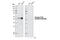 Phosphatase And Tensin Homolog antibody, 9549T, Cell Signaling Technology, Western Blot image 