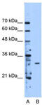 Methyltransferase Like 1 antibody, TA346738, Origene, Western Blot image 