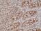 Carcinoembryonic Antigen Related Cell Adhesion Molecule 5 antibody, M00356-3, Boster Biological Technology, Immunohistochemistry frozen image 