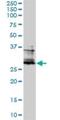 FOS Like 2, AP-1 Transcription Factor Subunit antibody, H00002355-M01, Novus Biologicals, Western Blot image 