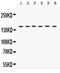 Rho Associated Coiled-Coil Containing Protein Kinase 2 antibody, PA5-79932, Invitrogen Antibodies, Western Blot image 