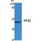 Adrenoceptor Beta 2 antibody, LS-C386835, Lifespan Biosciences, Western Blot image 