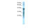 Proteasome 26S Subunit, ATPase 3 antibody, 27-750, ProSci, Western Blot image 