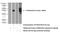 ST6 N-Acetylgalactosaminide Alpha-2,6-Sialyltransferase 5 antibody, 16442-1-AP, Proteintech Group, Western Blot image 